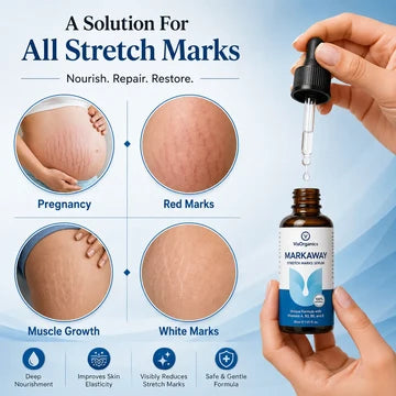 Markaway Stretch Mark Serum
